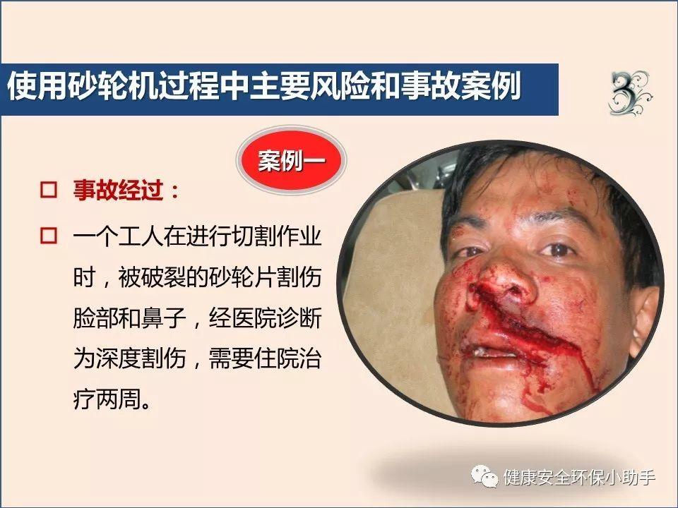 真杀人| 砂轮片|爆头、劈脸、剖腹......不忍看!!!胆小慎入@ 事故案例|含PPT| 砂轮机事故、防范措施及安全操作规程