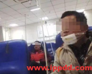 【砂轮机事故】脖子被切!不要再问为什么要安防护罩!