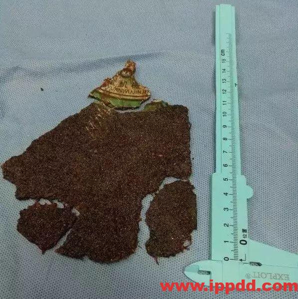 当场死亡！2020年砂轮机安全事故：不装防护罩的砂轮机就是杀人机！